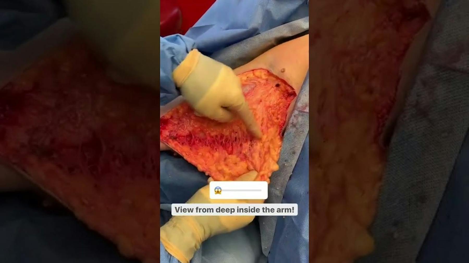 Colorado Plastic Surgery Center