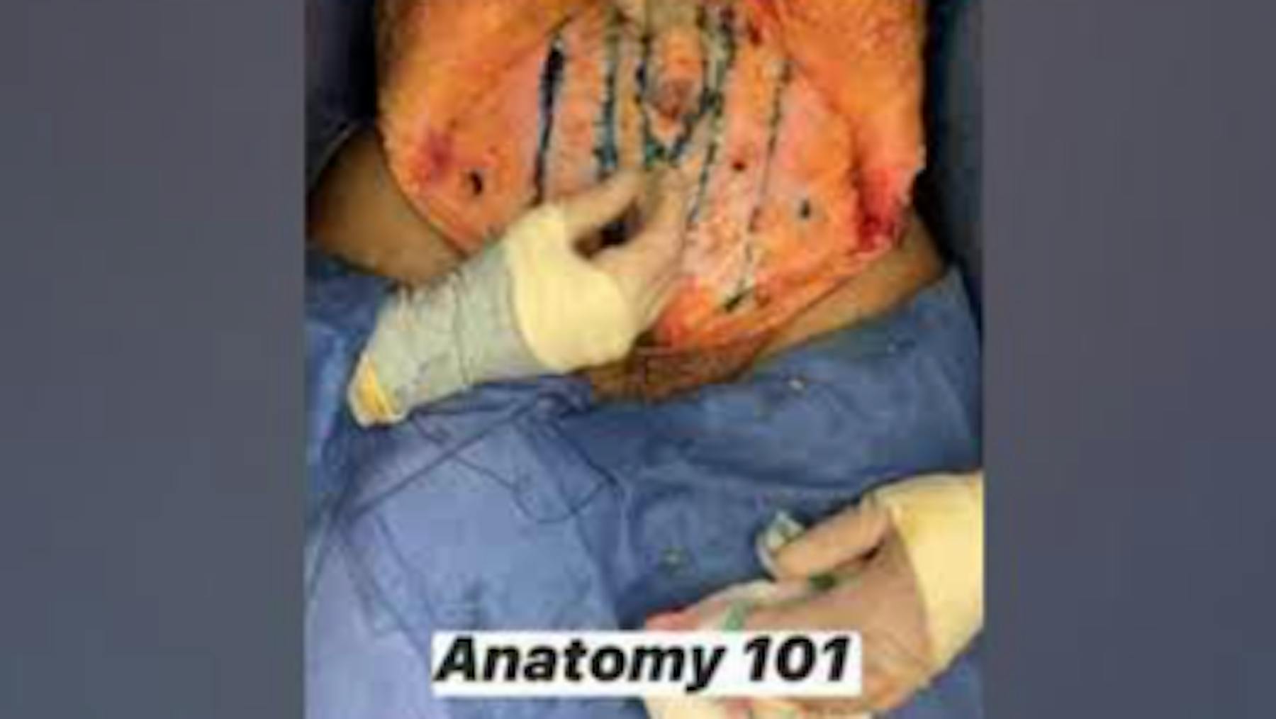 Colorado Plastic Surgery Center