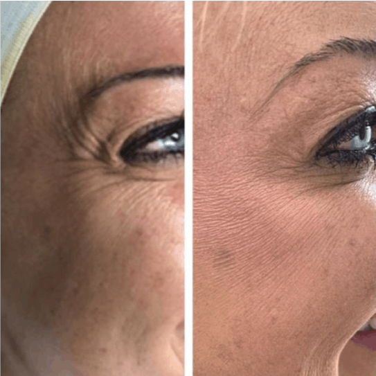 patient results