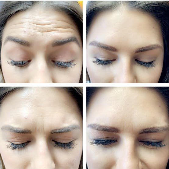 patient results