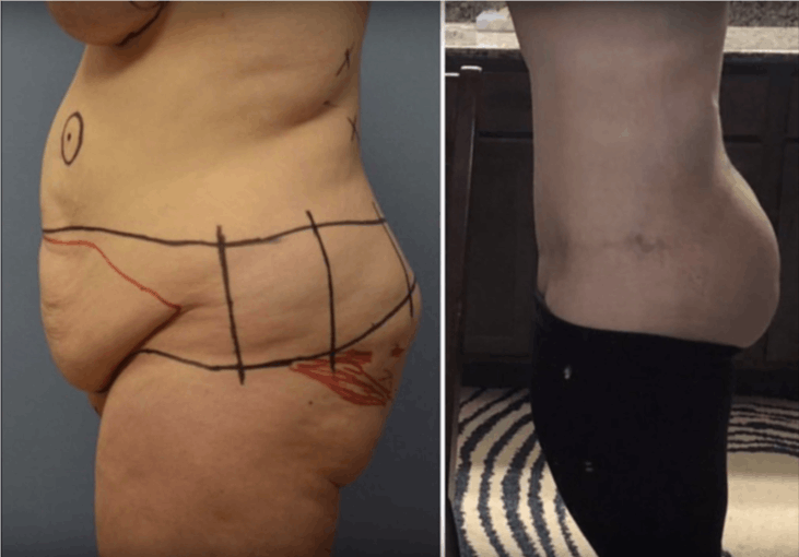patient results