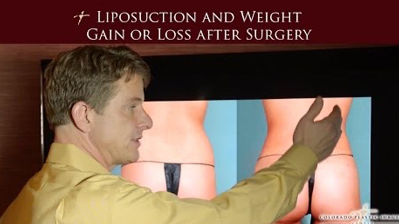 liposuction video