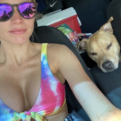 Selfie Gallery Before & After Gallery - Patient 285973 - Image 2