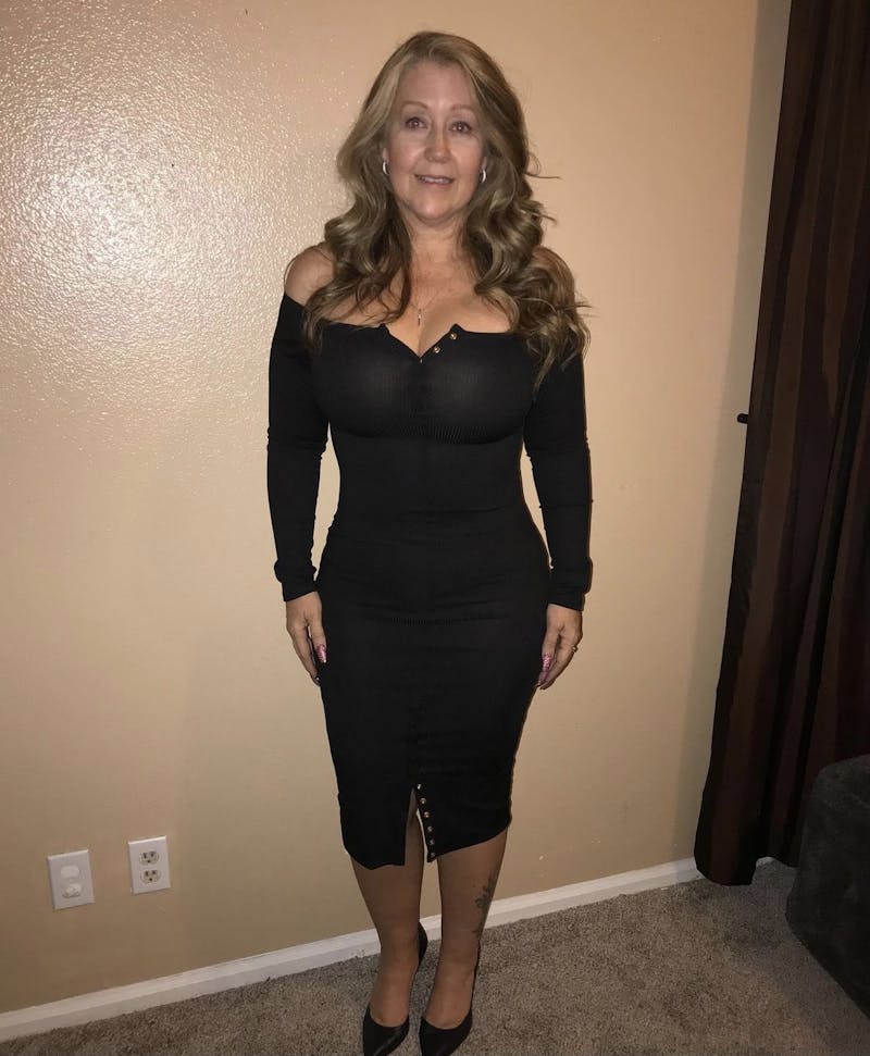 Selfie Gallery Before & After Gallery - Patient 459956 - Image 2