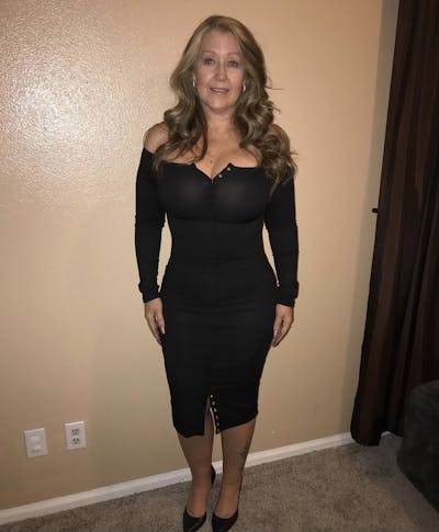 Selfie Gallery Before & After Gallery - Patient 459956 - Image 2