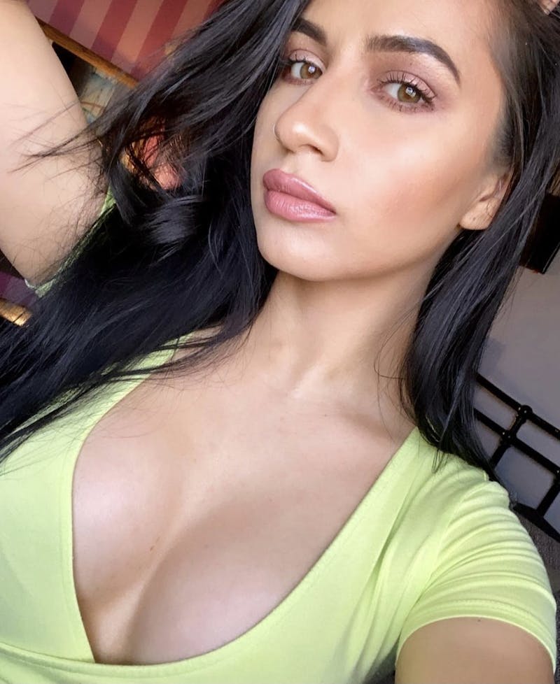 Selfie Gallery Before & After Gallery - Patient 352838 - Image 2