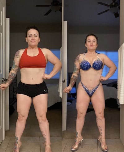 Selfie Gallery Before & After Gallery - Patient 368066 - Image 2