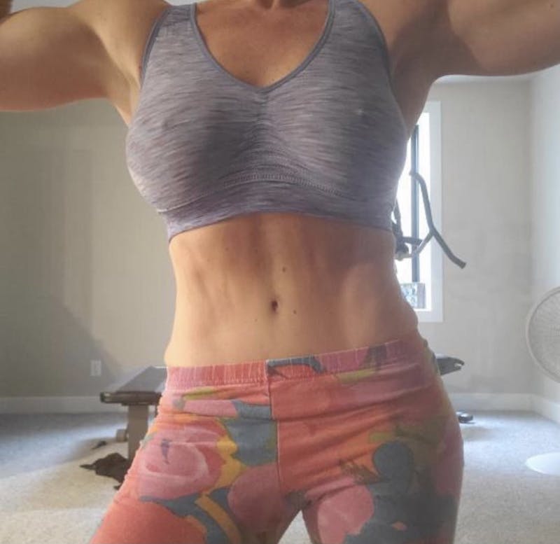 Selfie Gallery Before & After Gallery - Patient 819668 - Image 2