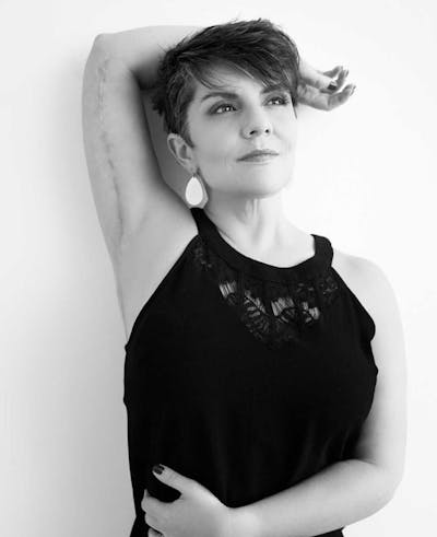 Selfie Gallery Before & After Gallery - Patient 229745 - Image 2