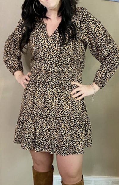 Selfie Gallery Before & After Gallery - Patient 324510 - Image 2