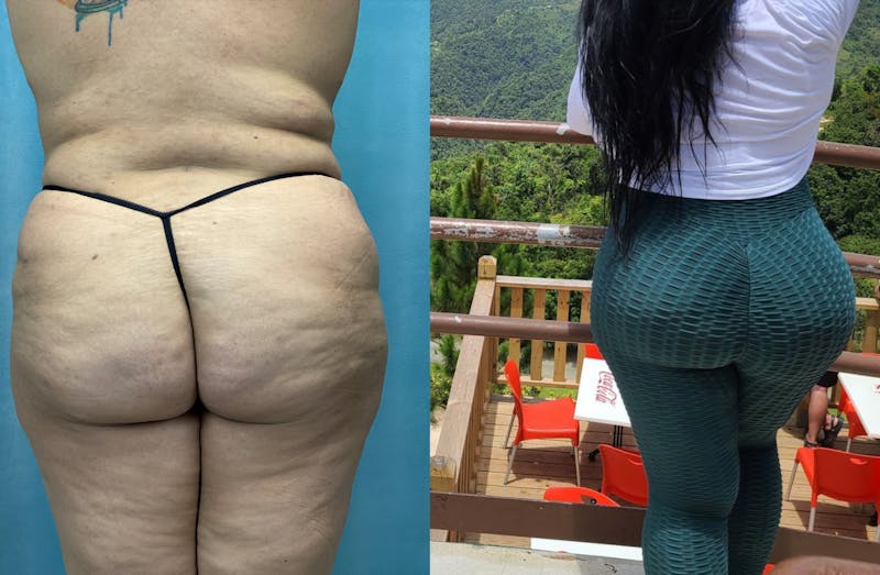 Selfie Gallery Before & After Gallery - Patient 408276 - Image 1