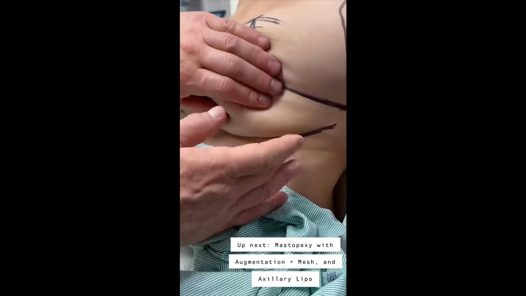 Colorado Plastic Surgery Center