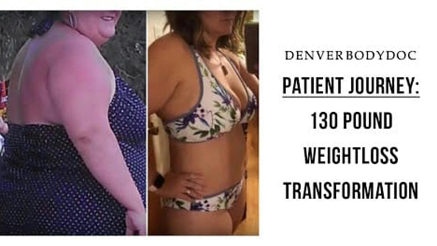 Colorado Plastic Surgery Center