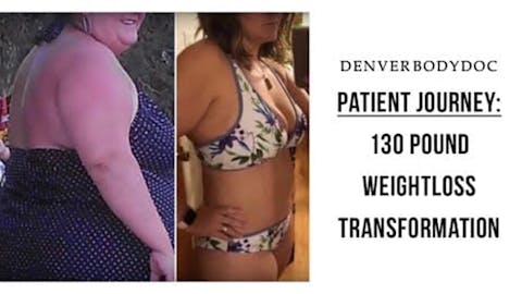 Colorado Plastic Surgery Center