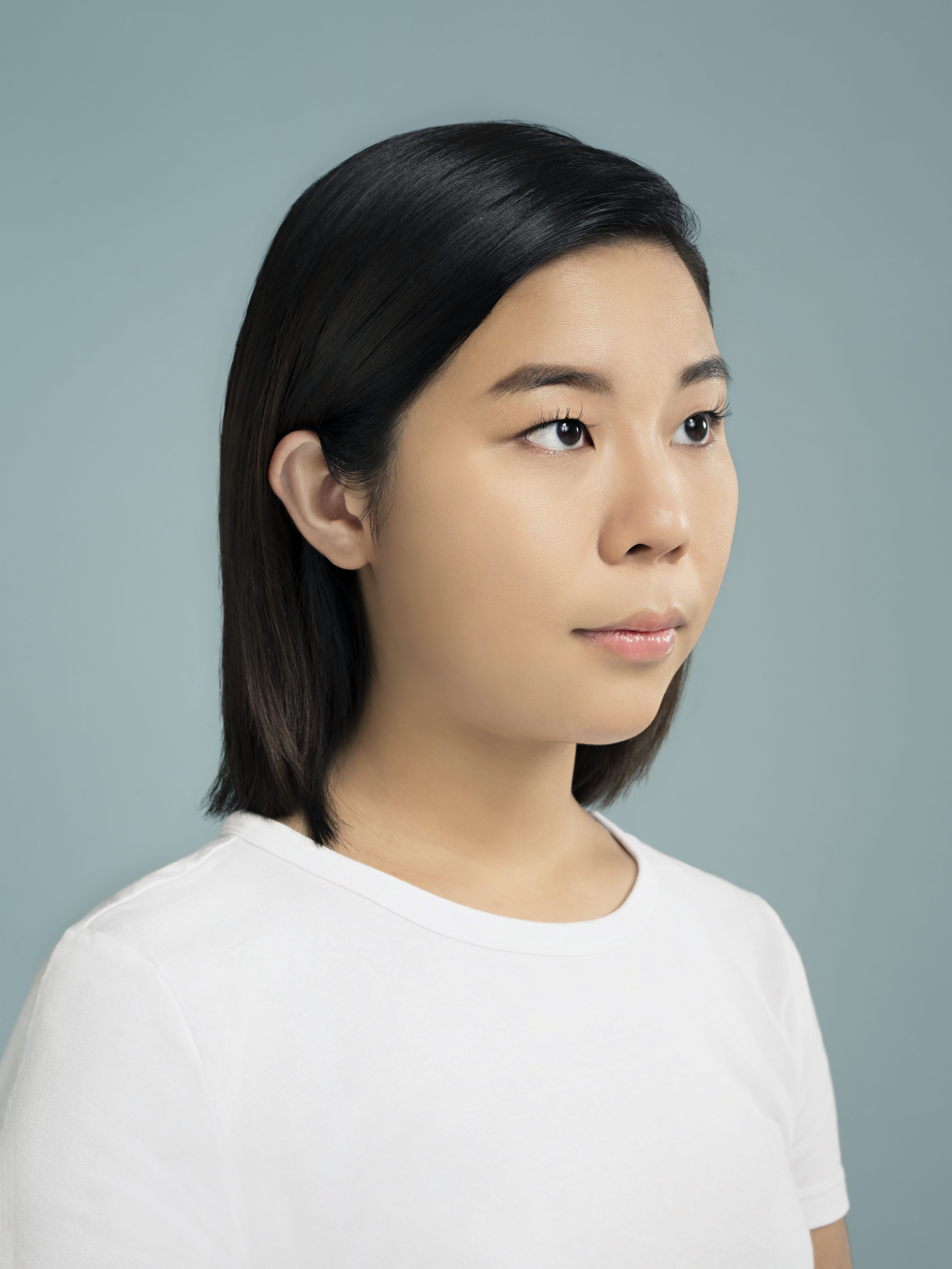 restylane patient