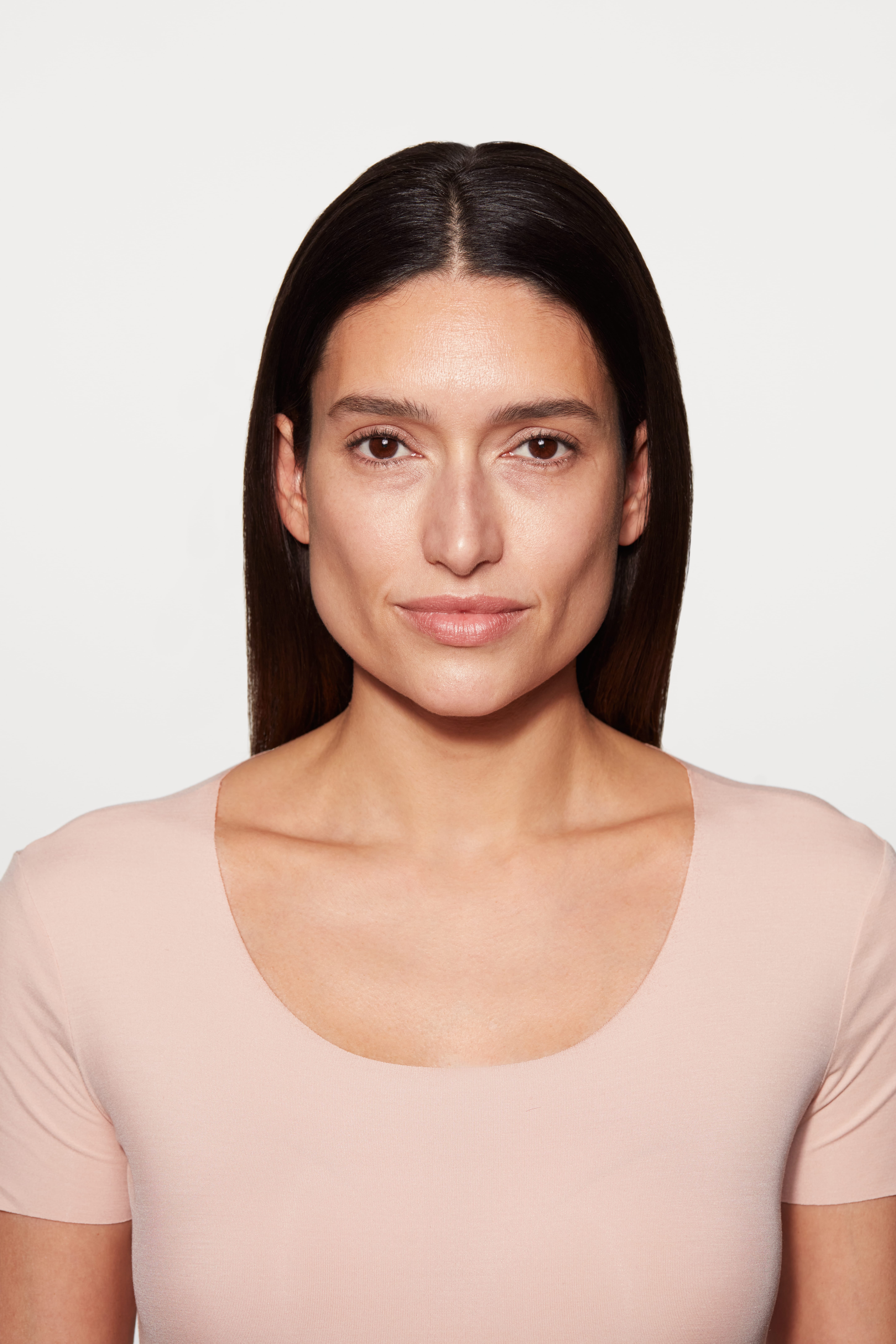 sculptra patient