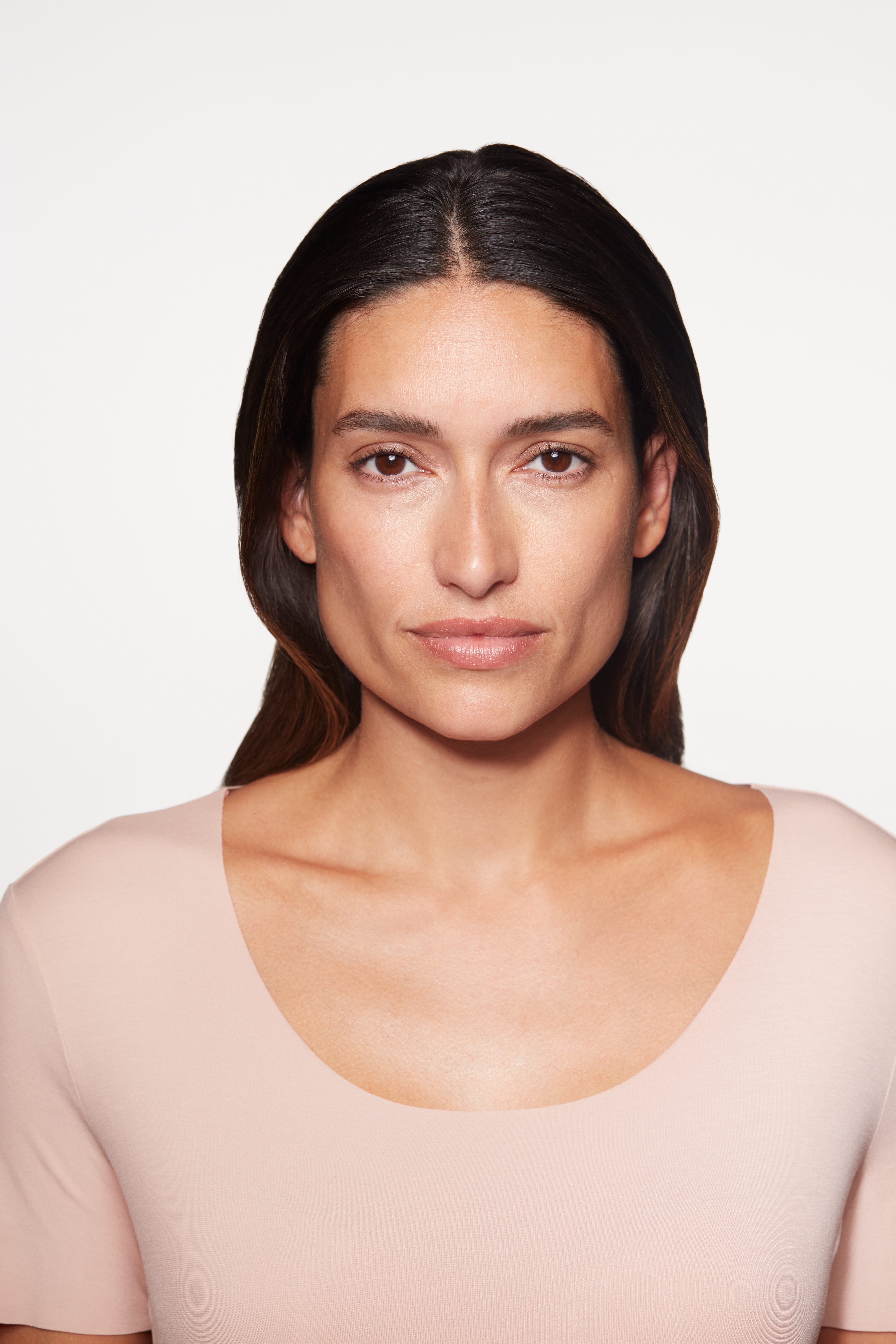 sculptra patient