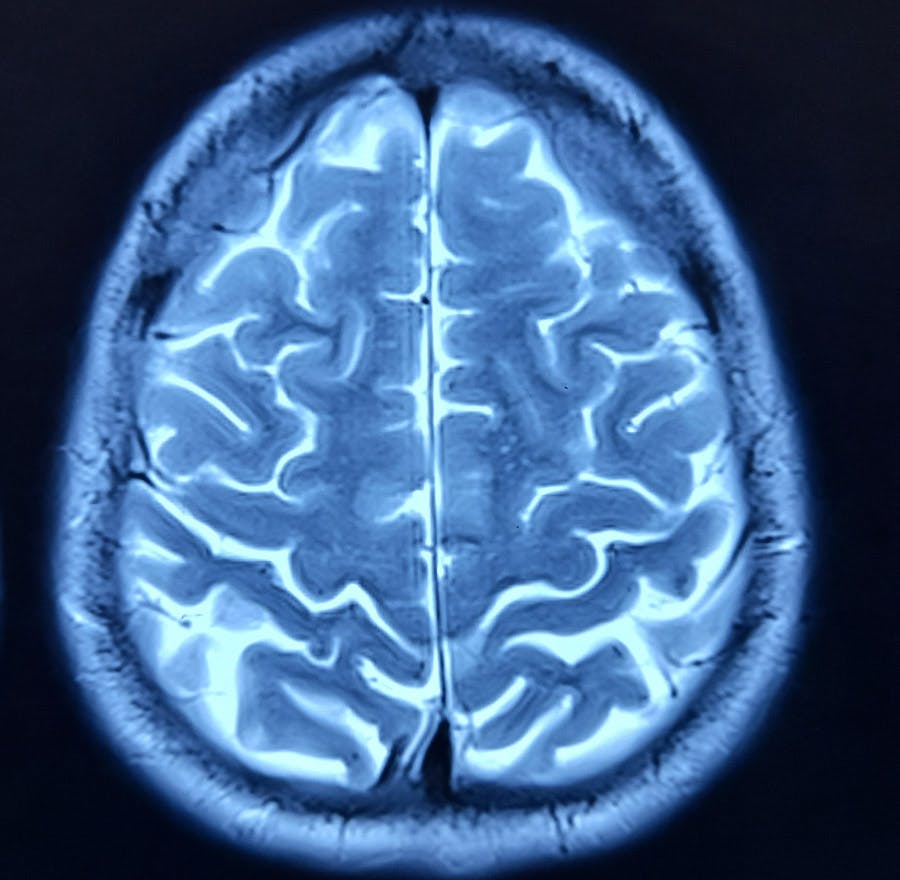 an x-ray image of a brain