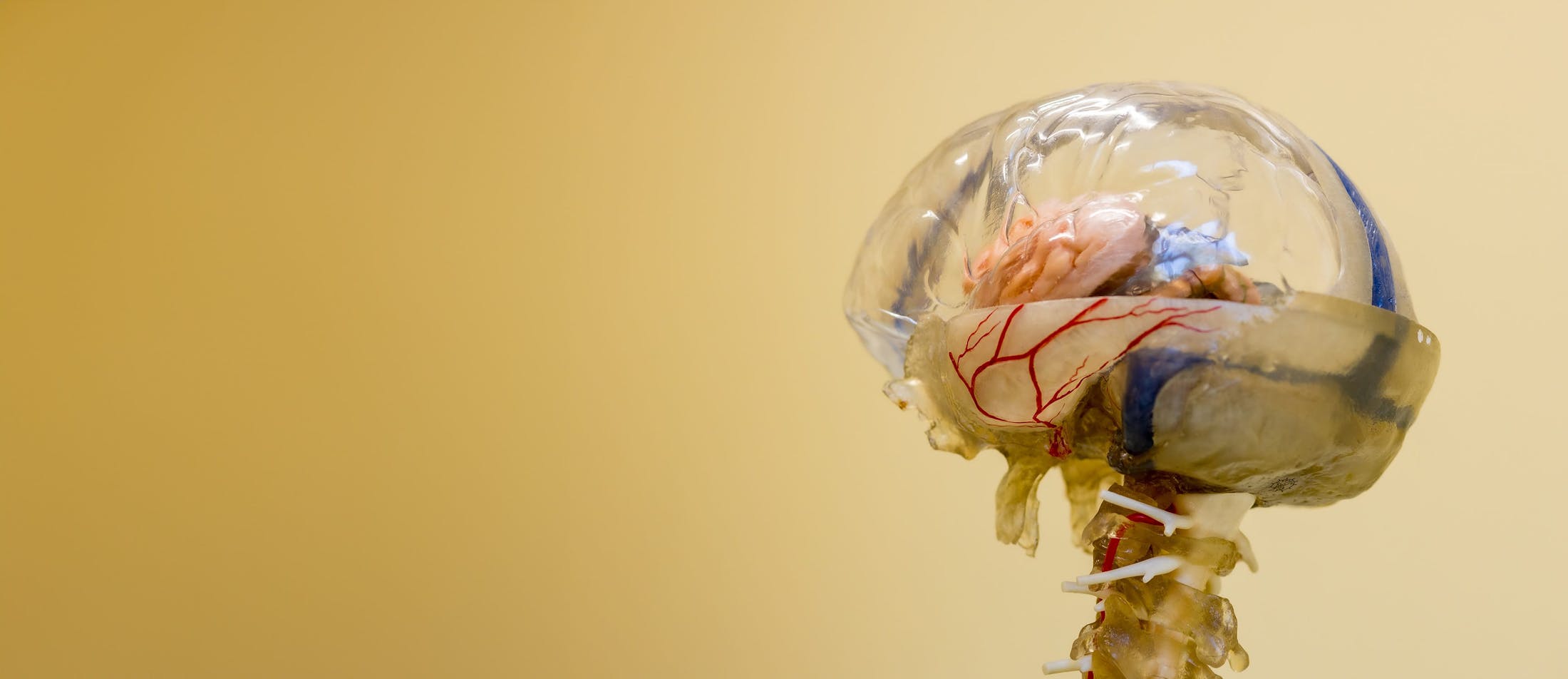 plastic brain