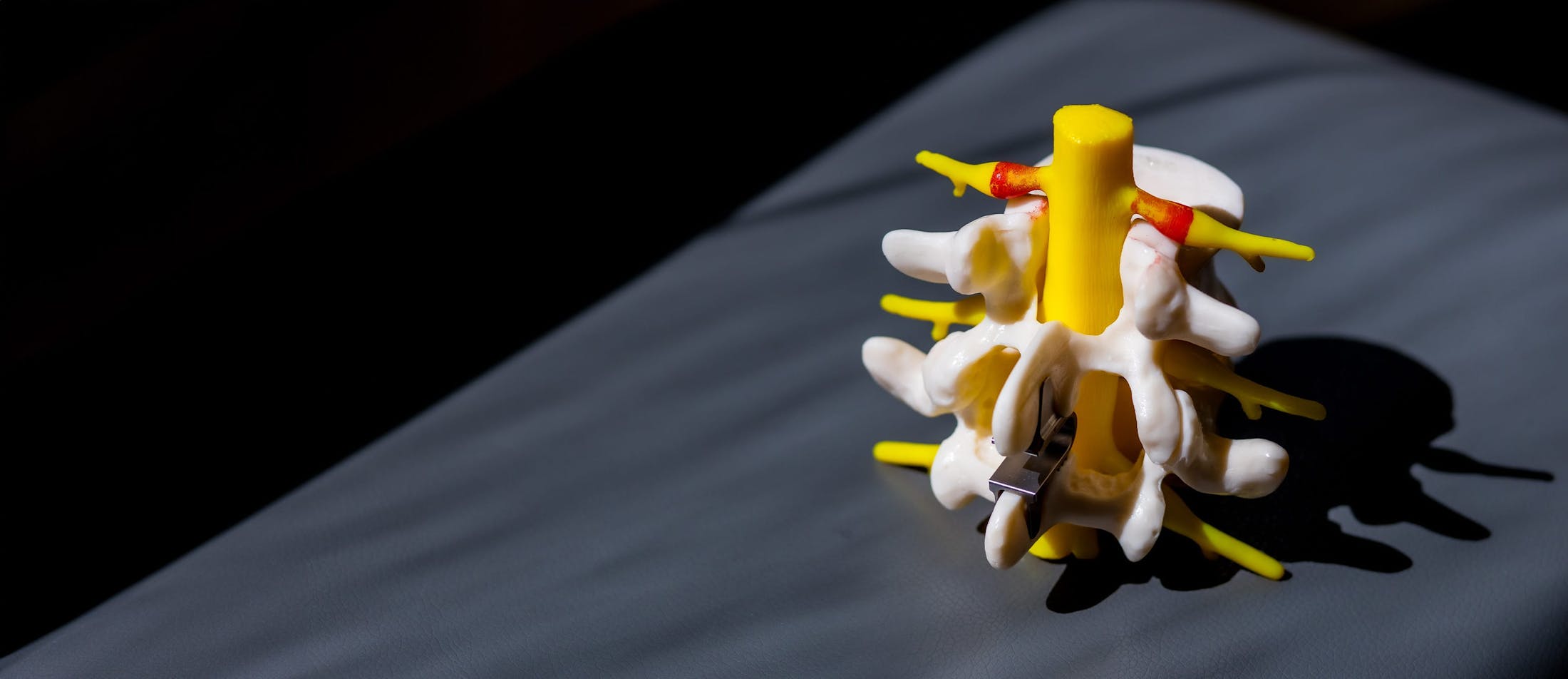 plastic spine