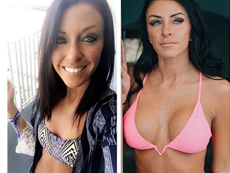 Before and after photos of Kallie