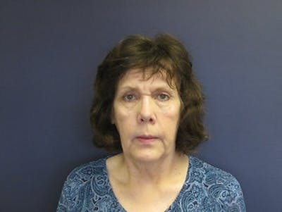 Brow Lift Before & After Gallery - Patient 403191 - Image 1