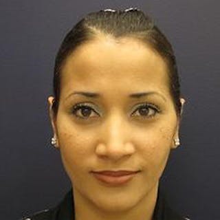 Ear Surgery Before & After Gallery - Patient 160899 - Image 2