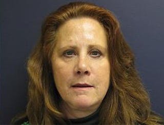 Eyelid Surgery Before & After Gallery - Patient 142253 - Image 2