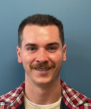 FUE Hair Restoration Before & After Gallery - Patient 208667 - Image 2