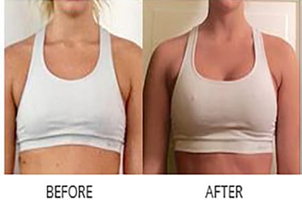 patient results