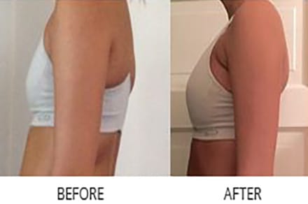 patient results