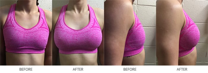 woman before and after