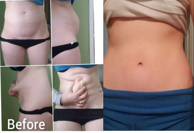 patient results