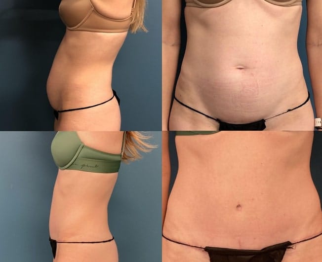 patient results