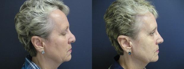 patient results