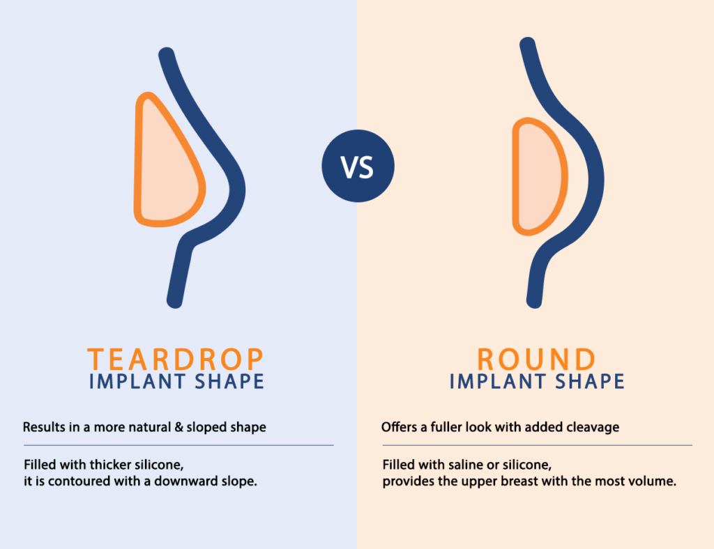 breast implant profile infographic