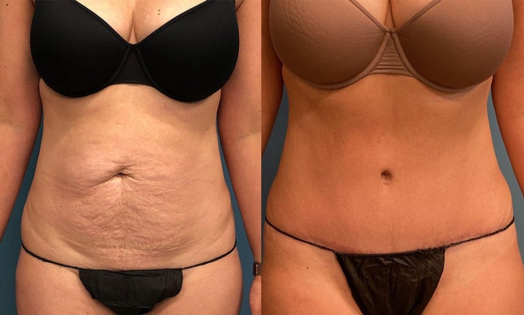 patient results