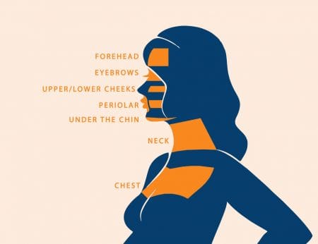 ultherapy infographic