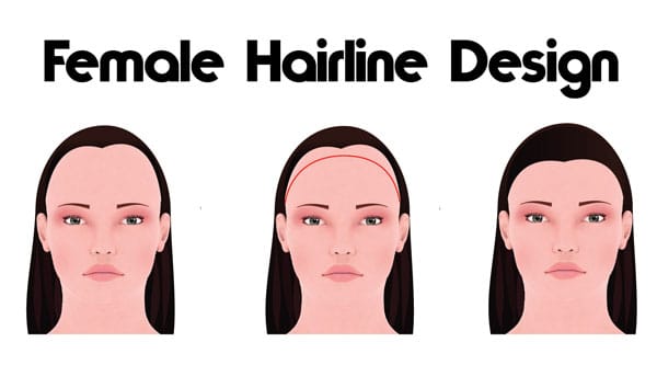 female hairline infographic