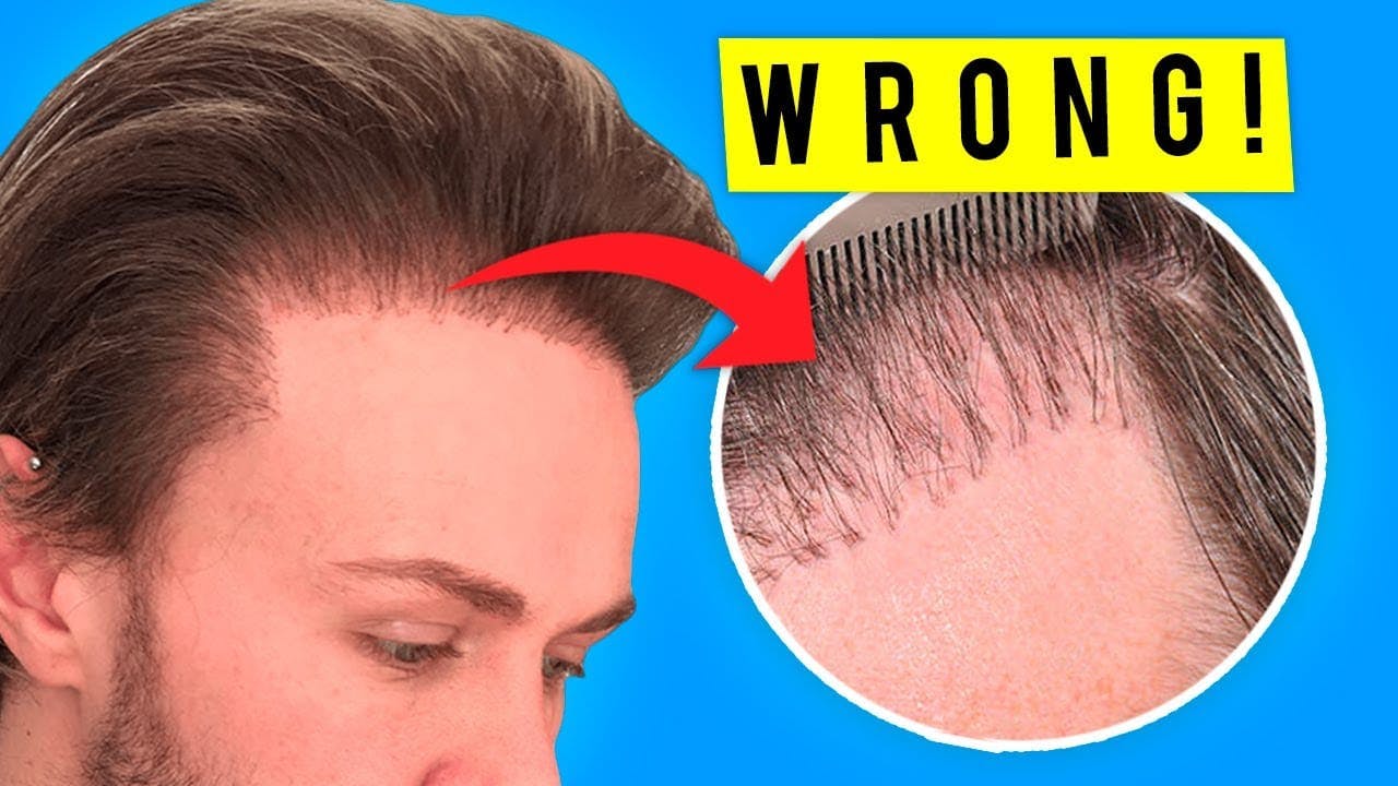 hair restoration video