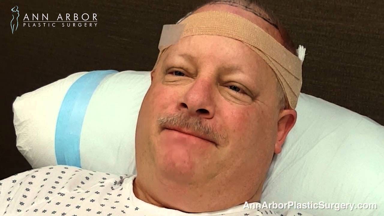 hair transplant video