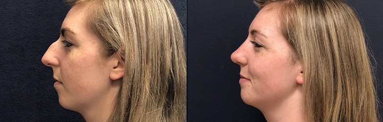 patient results