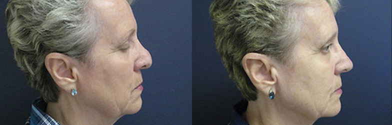 patient results