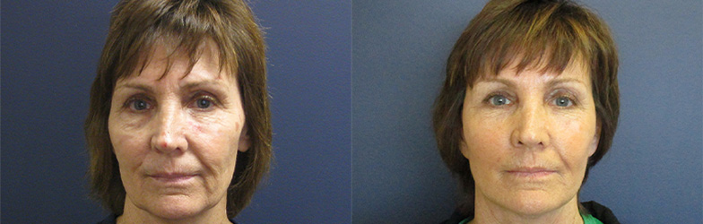 patient results