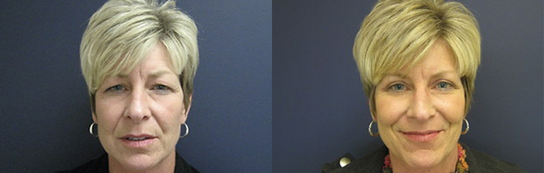 patient results