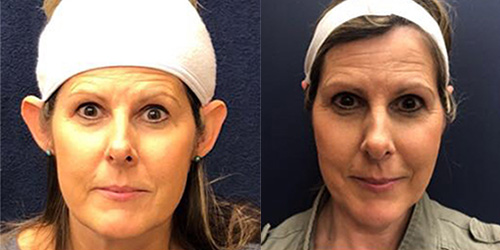 patient results