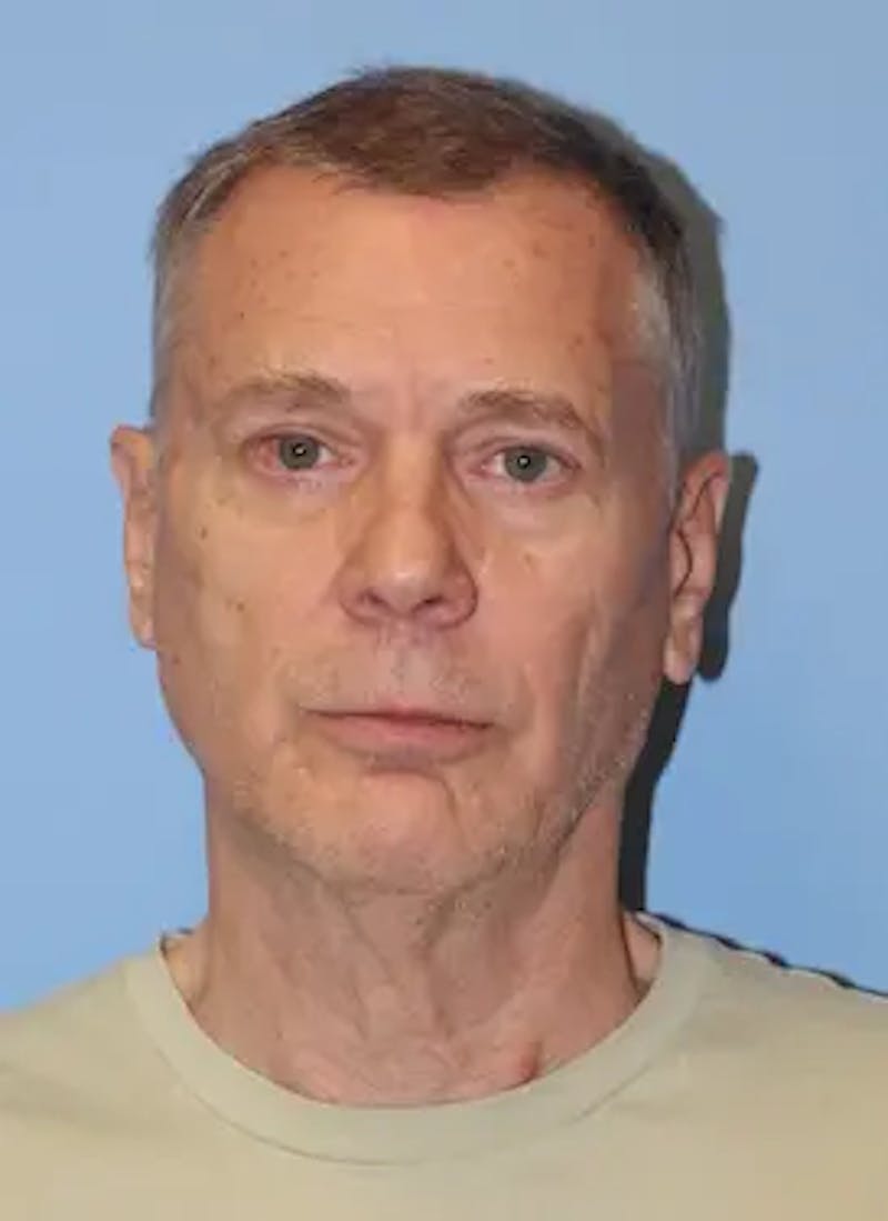Male Facelift Before & After Gallery - Patient 178732 - Image 1