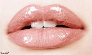 Lip-augmentation-Beverly-Hills