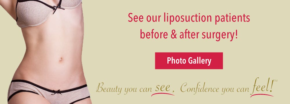 Liposuction before and after gallery - Dr Firouz