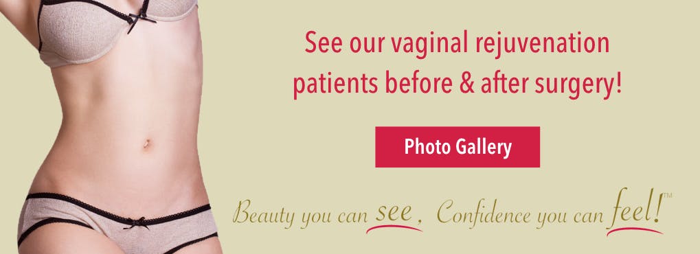 Before & After Labiaplasty
